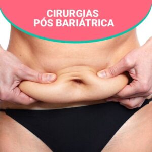 Cirurgia pós bariátrica: como se preparar?