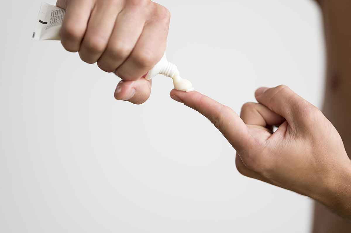 Mitos e verdades sobre tratamentos caseiros para queimaduras Mitos e verdades sobre tratamentos caseiros para queimaduras